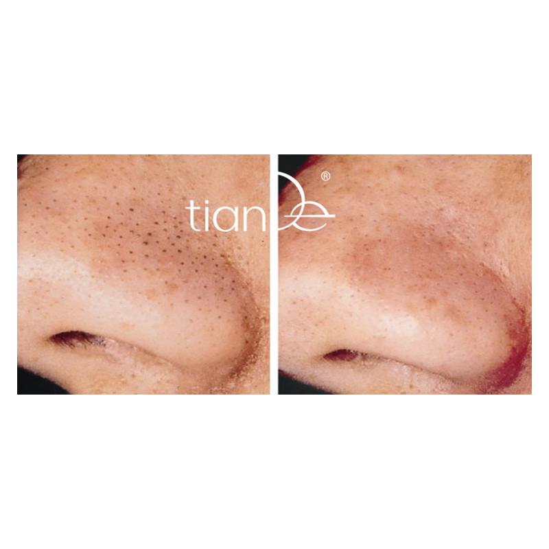 11317 Yeso Limpieza Nasal "Limpia los Poros." TianDe, Piel Sin Puntos Negros!, Diseñado para la Limpieza Profunda