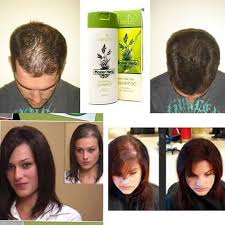 21310 Champú anticaída del cabello TIANDE 420 ml