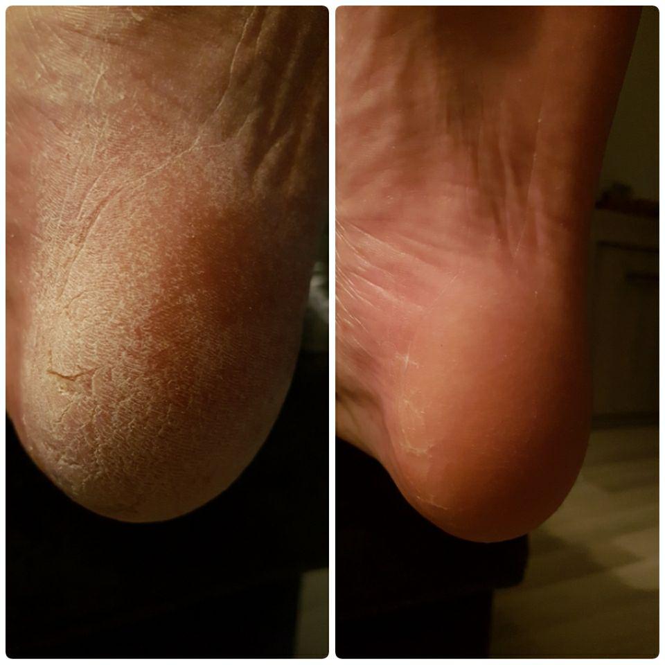 41101 Crema de Pies con Grasa de Serpiente TIANDE 80 ml, Regeneración de los tejidos dañados