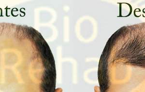 TianDe 23401 Champú activador del crecimiento del cabello,