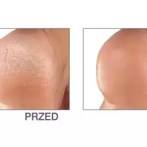 Lima Eléctrica para Pies ELDOM PP10, Rollo con Microgranulas, 3 Watios - Imagen 3